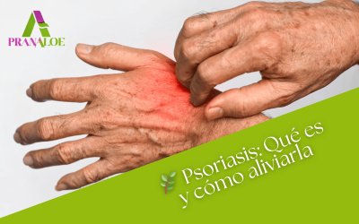 Psoriasis: Qué es, cómo aliviarla y cómo los productos naturales de Pranaloe pueden ayudarte